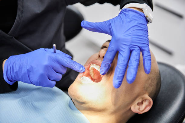 Best Emergency Treatment for Dental Infections or Abscesses in Belleview, FL